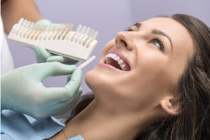Come si mettono le faccette ai denti